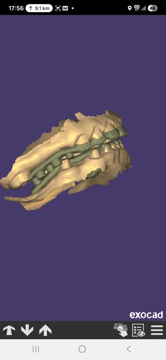 CAD/CAM crown and prosthetic work